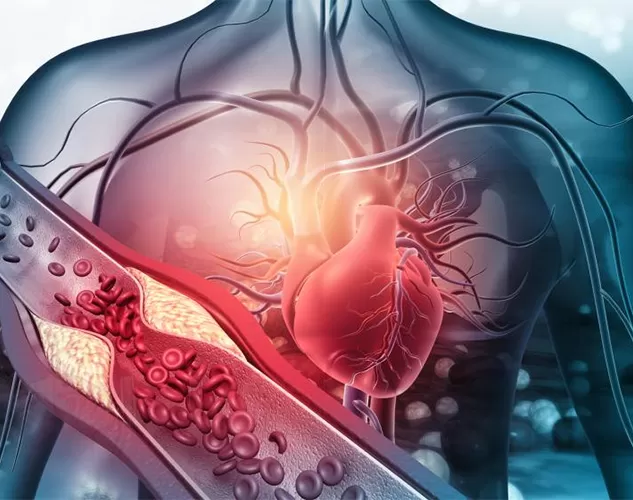 Attenzione alla morte cardiaca immediata: sventare il Killer vascolare silenzioso e silenzioso e come la vitamina K2 protegge il cuore