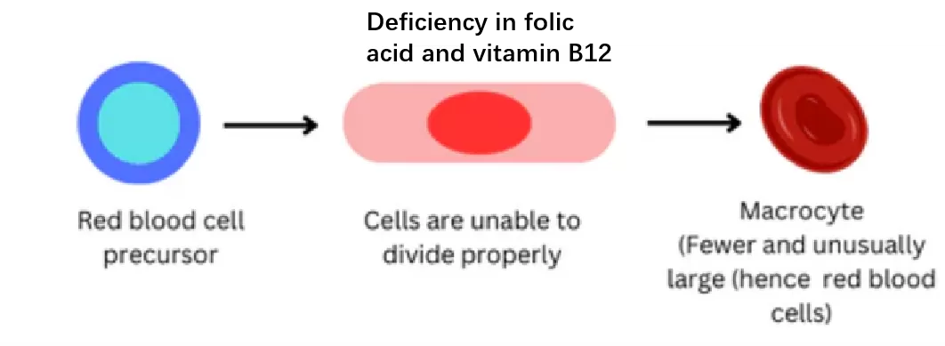 deficiency in folic acid and vitamin b12